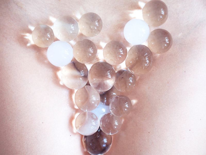 © Pauline Batista - Implantation