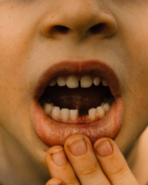 © Olivia de Villaine - Image from the In My Flesh photography project