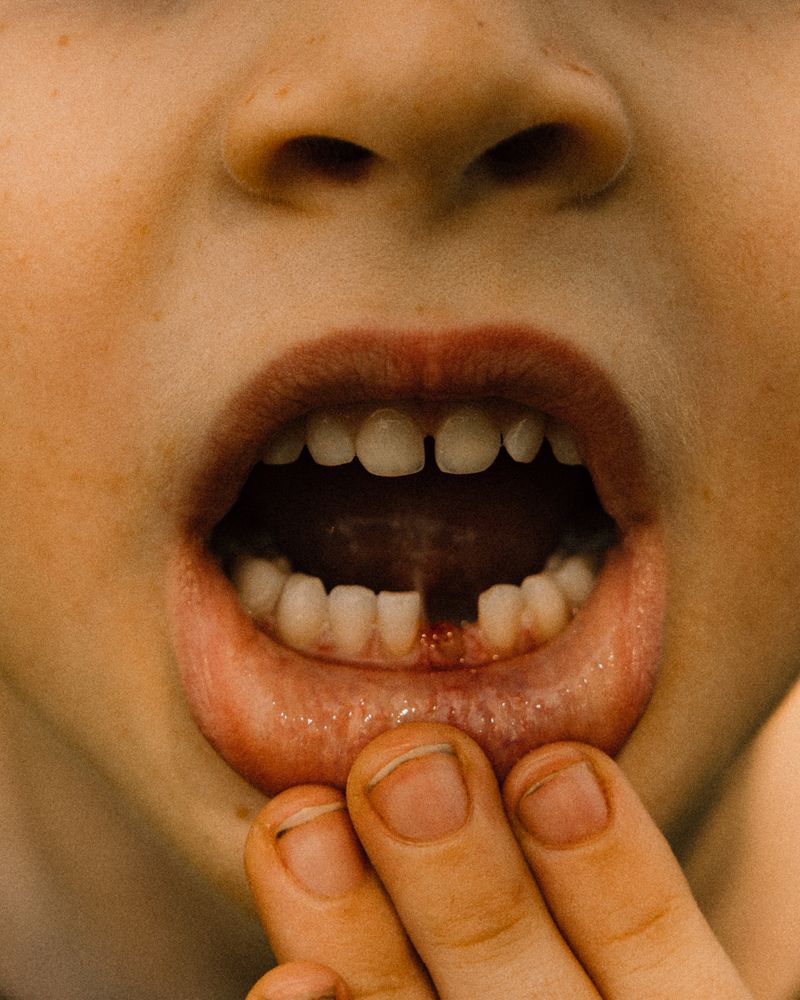 © Olivia de Villaine - Image from the In My Flesh photography project