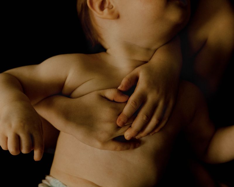 © Olivia de Villaine - Image from the In My Flesh photography project