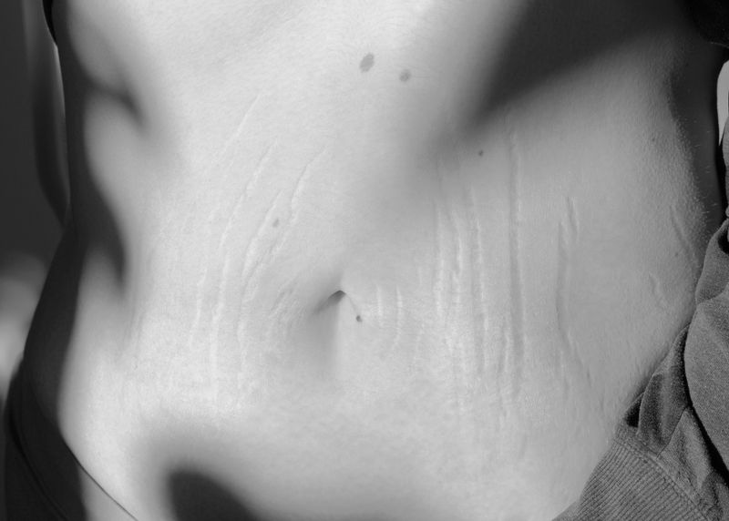 © Martina Lajczak - „Skin breaks when the heart gets fuller“, 2024.