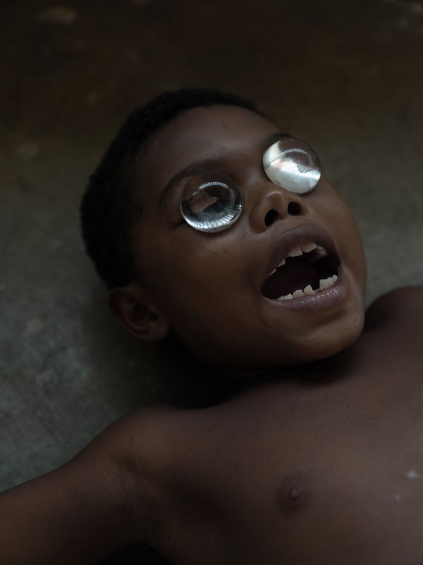 © Santiago Escobar-Jaramillo - a fish child opens its mouth seeking to feed. Rincón del Mar, Sucre. 2021.