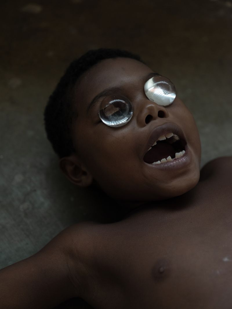 © Santiago Escobar-Jaramillo - a fish child opens its mouth seeking to feed. Rincón del Mar, Sucre. 2021.