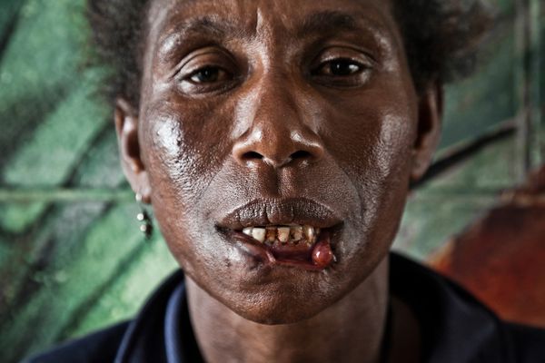 © Vlad Sokhin - Image from the Crying Meri. Violence Against Women in Papua New Guinea photography project