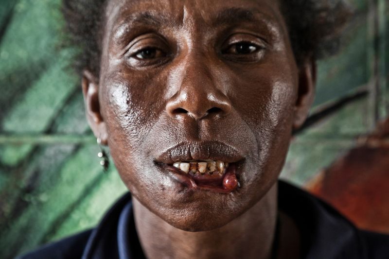 © Vlad Sokhin - Image from the Crying Meri. Violence Against Women in Papua New Guinea photography project