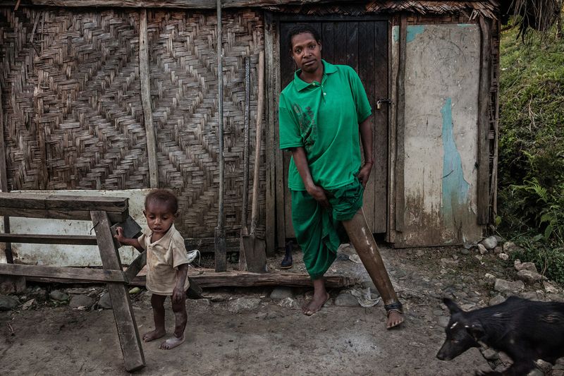 © Vlad Sokhin - Image from the Crying Meri. Violence Against Women in Papua New Guinea photography project