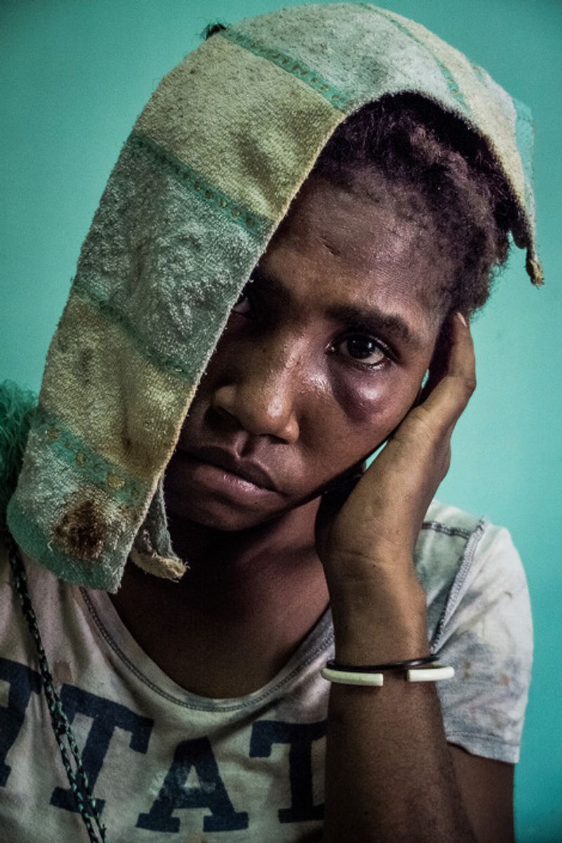 © Vlad Sokhin - Image from the Crying Meri. Violence Against Women in Papua New Guinea photography project