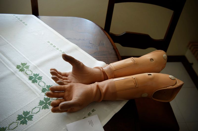 © Tommaso Rada - The prothesis of Mr Fortuna; he lost both his arms after an explosion during the war in Guinea Bissau