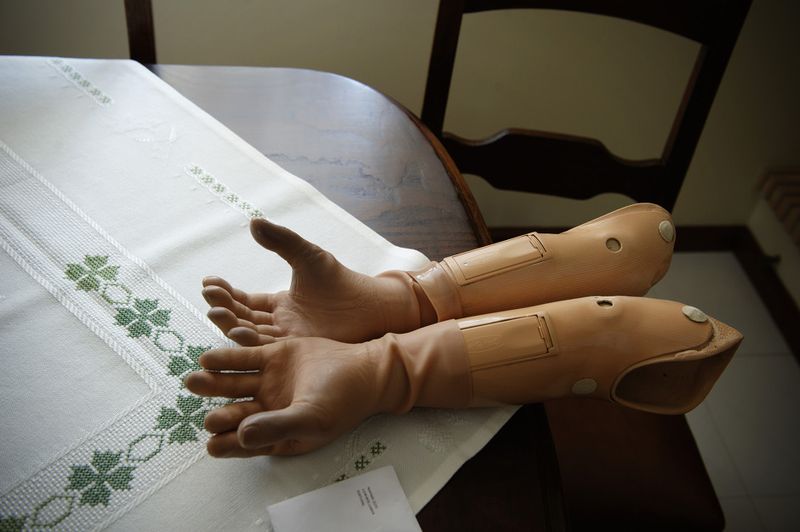 © Tommaso Rada - The prothesis of Mr Fortuna; he lost both his arms after an explosion during the war in Guinea Bissau