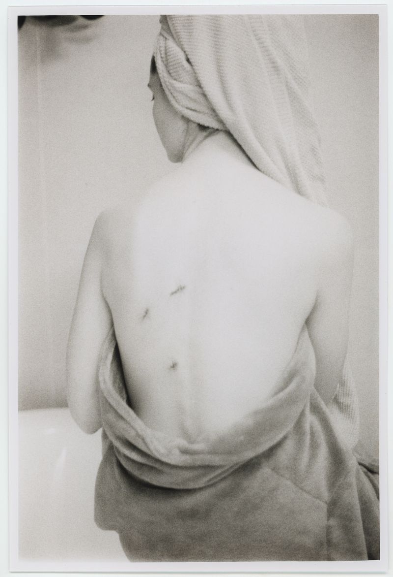 © Tereza Červeňová - Scars. ("STAY is a sensitive word. We wear who stayed and who left in our skin forever.") nayyirah waheed