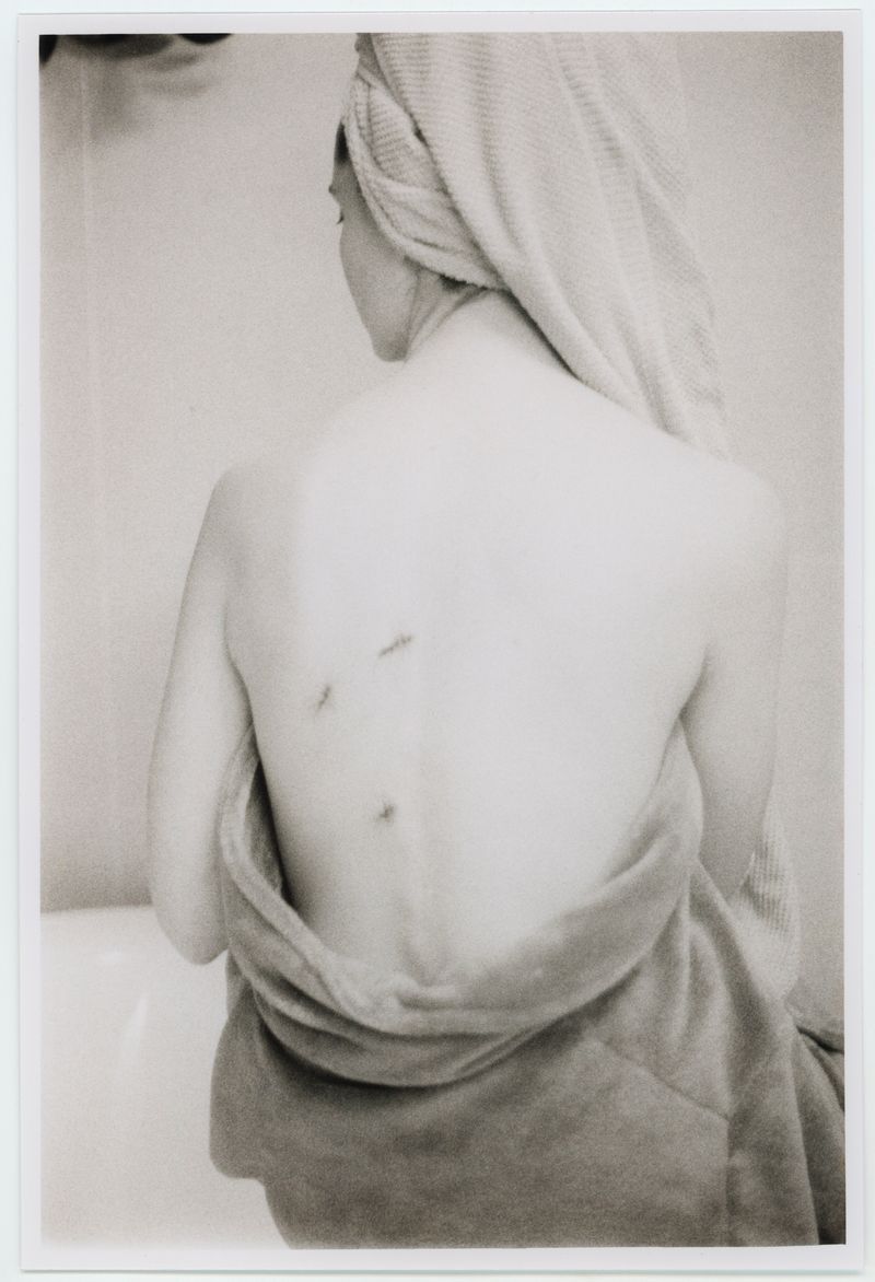 © Tereza Červeňová - Three Scars. ("STAY is a sensitive word. We wear who stayed and who left in our skin forever.") nayyirah waheed