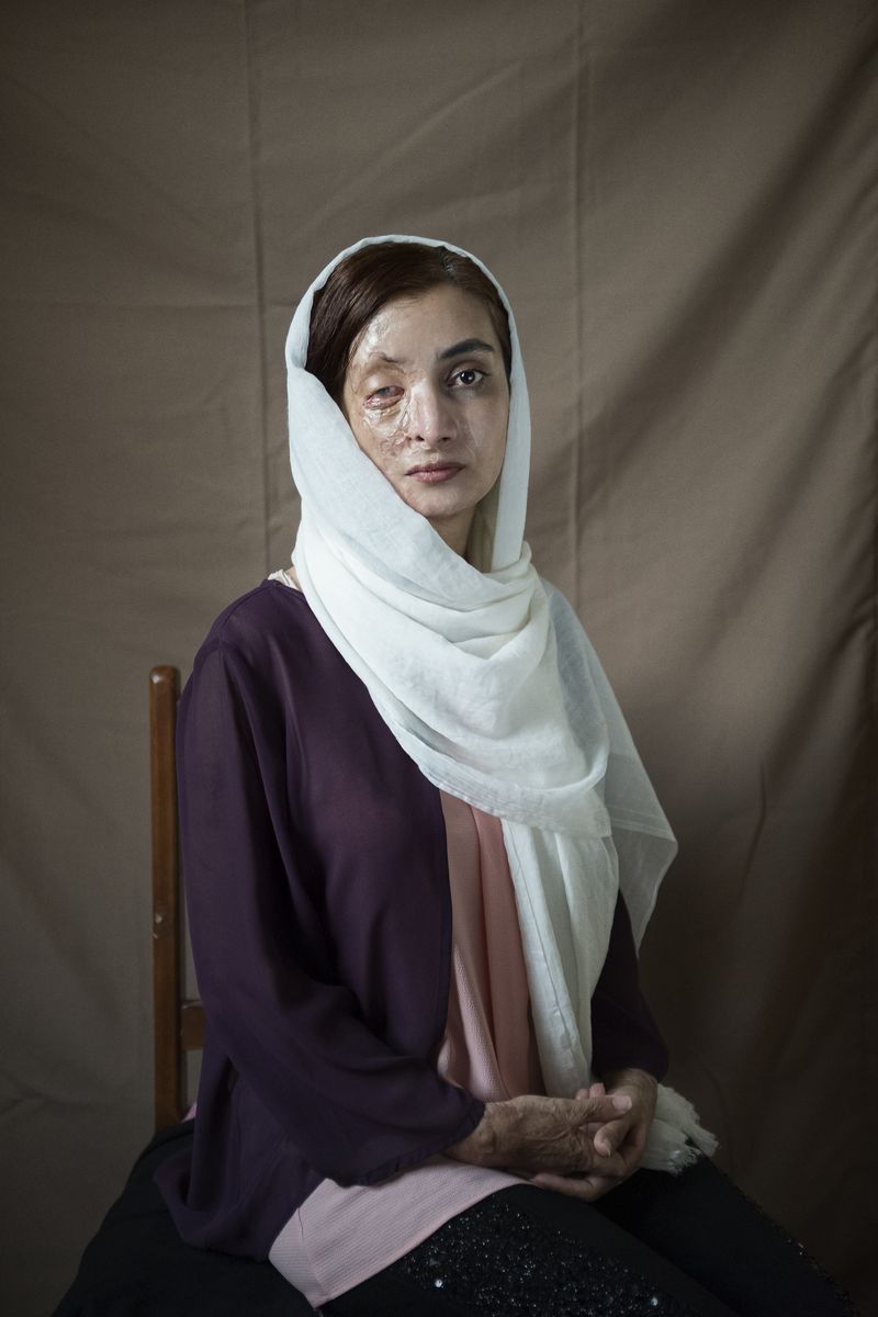 © sima choubdarzadeh - Image from the The lotus seeds sprout photography project