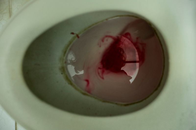 © sima choubdarzadeh - The woman is surrounded by blood.