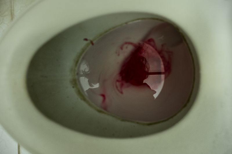 © sima choubdarzadeh - The woman is surrounded by blood.