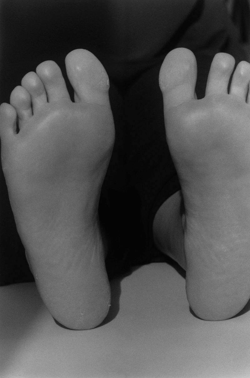 © Mirielle Rohr - Jule, 24 years old, type 1 diabetes