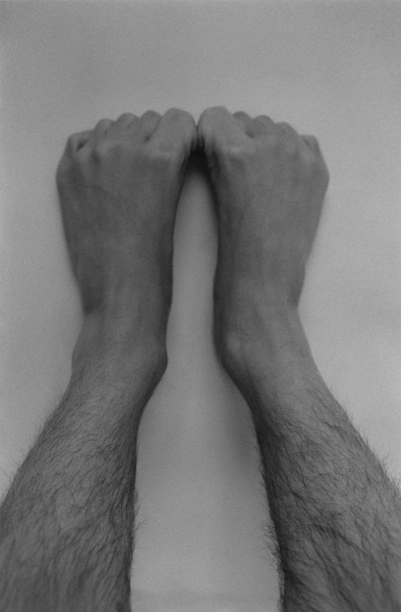 © Mirielle Rohr - Lorenzo, 29 years old, neurodermatitis