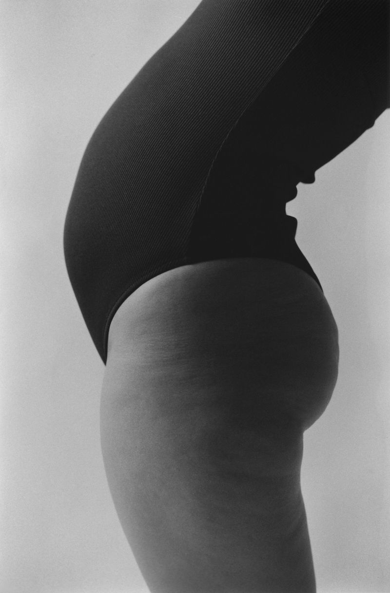 © Mirielle Rohr - Lydia, 29 years old, endometriosis