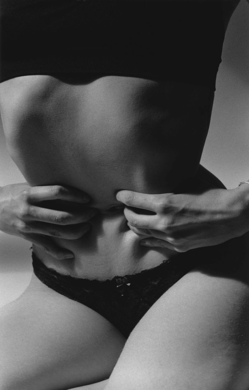 © Mirielle Rohr - Me, 25 years old, irritable bowel syndrome