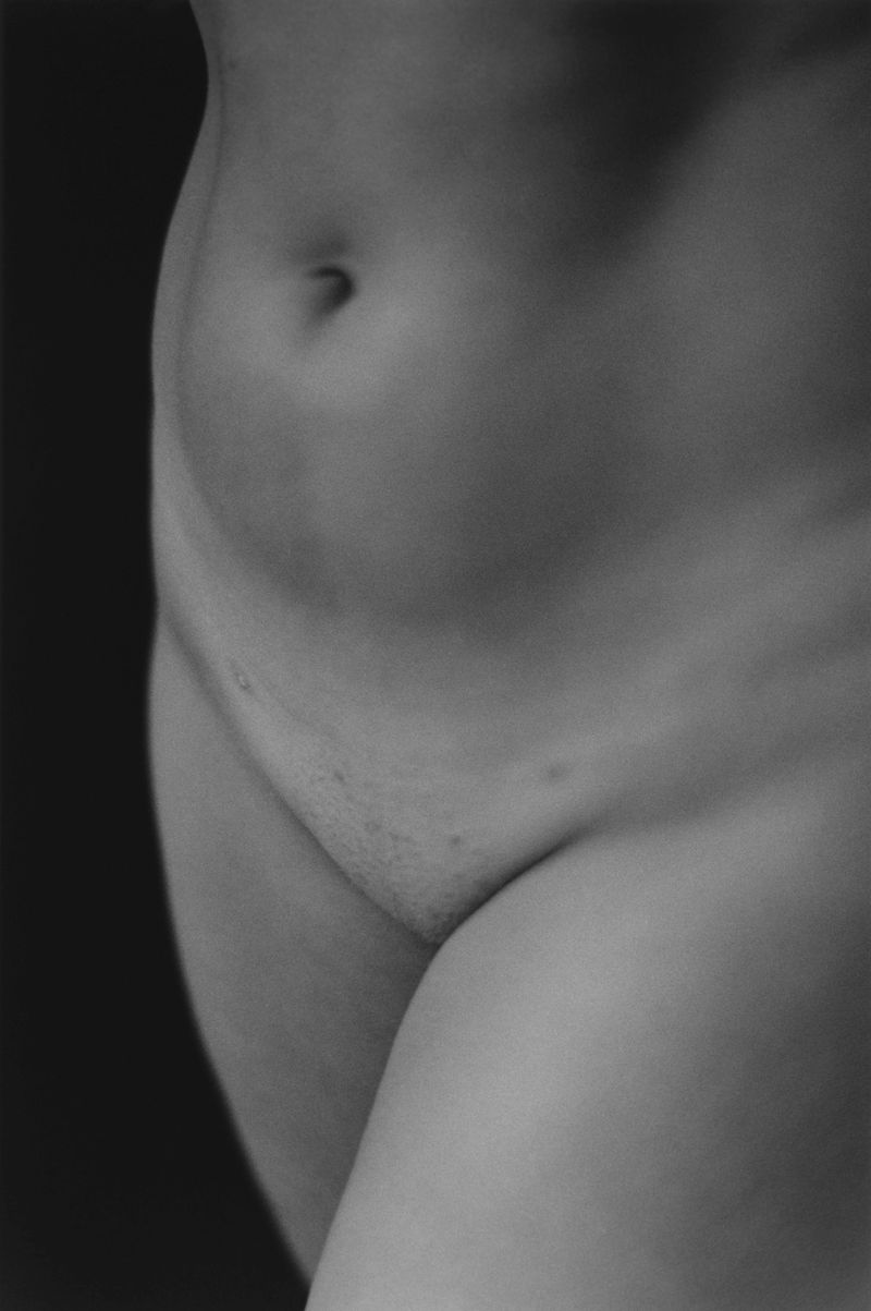 © Mirielle Rohr - Lydia, 29 years old, endometriosis
