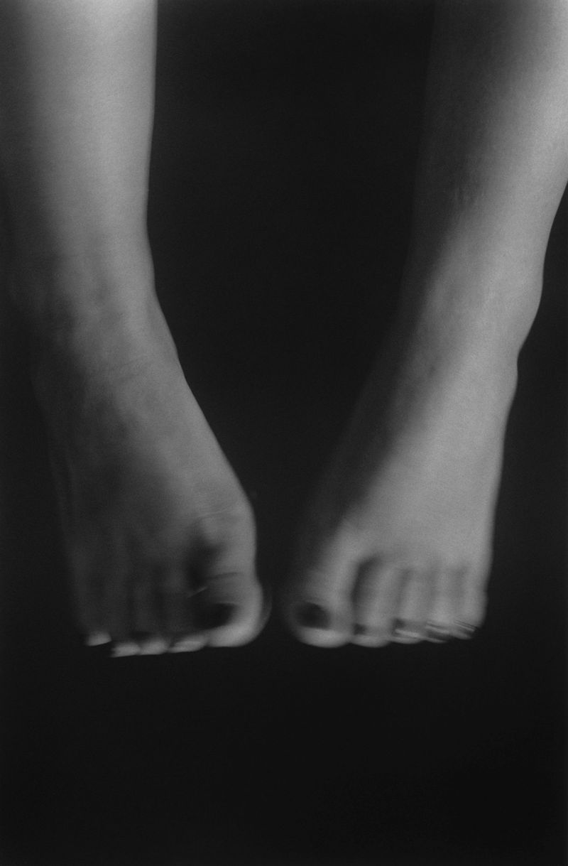 © Mirielle Rohr - Lydia, 29 years old, endometriosis