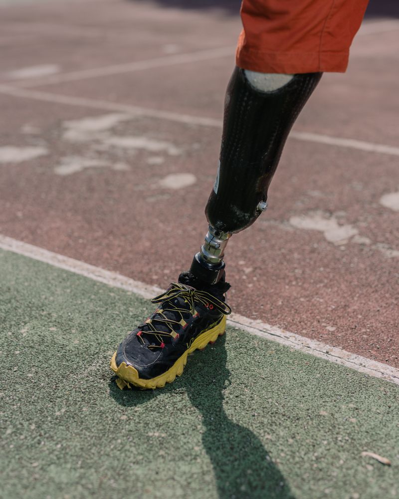 © Francesco Andreoli - Andrea’s leg prosthesis.