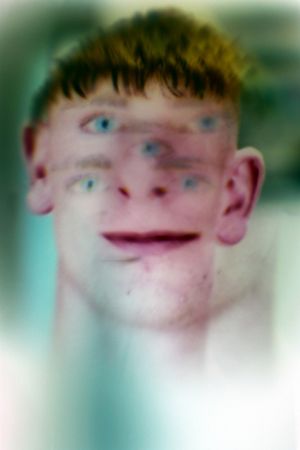 From Eye to Bone