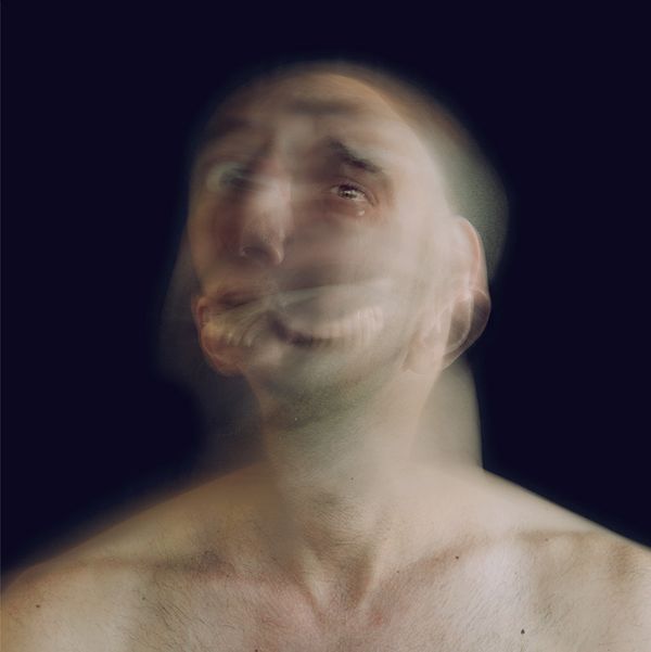© Daniel - Image from the Across the Wound photography project