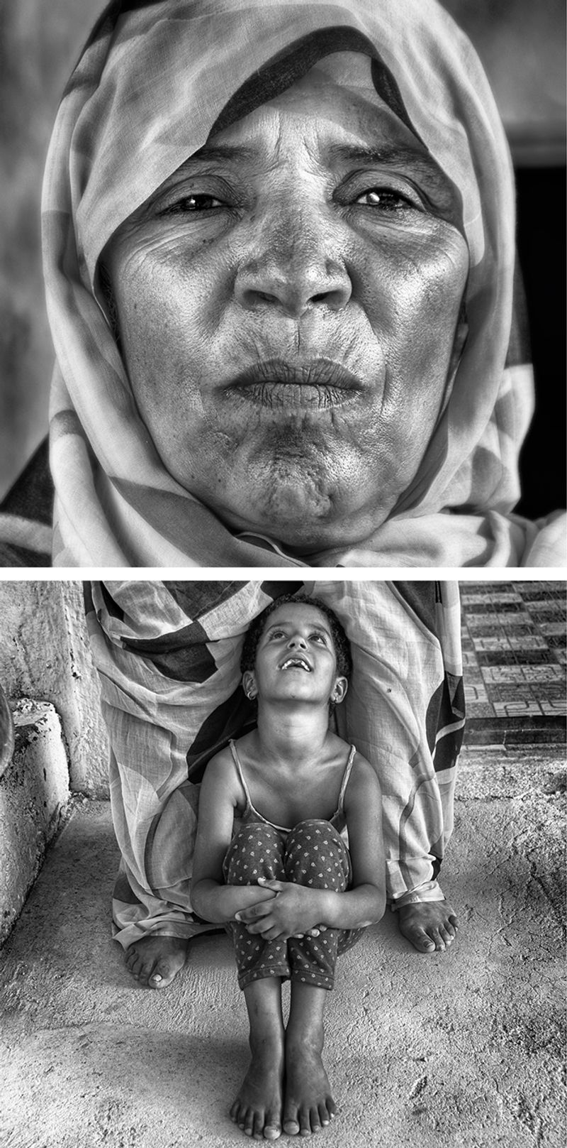 © Daniel - Image from the Across the Wound photography project