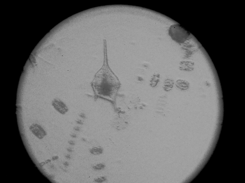 © Akosua Viktoria Adu-Sanyah - toxic algae phytoplankton species as a result of climate change