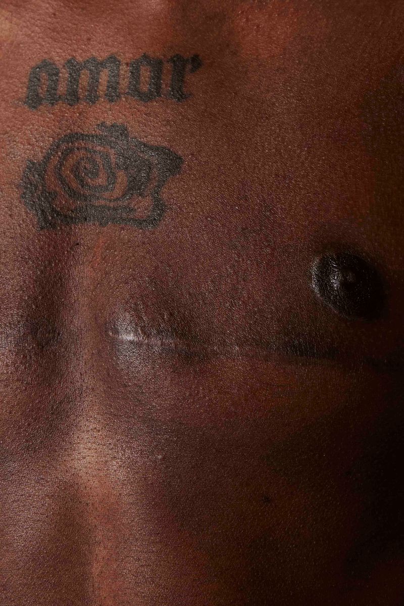 © Prisca Tozzi - Image from the SKIN photography project