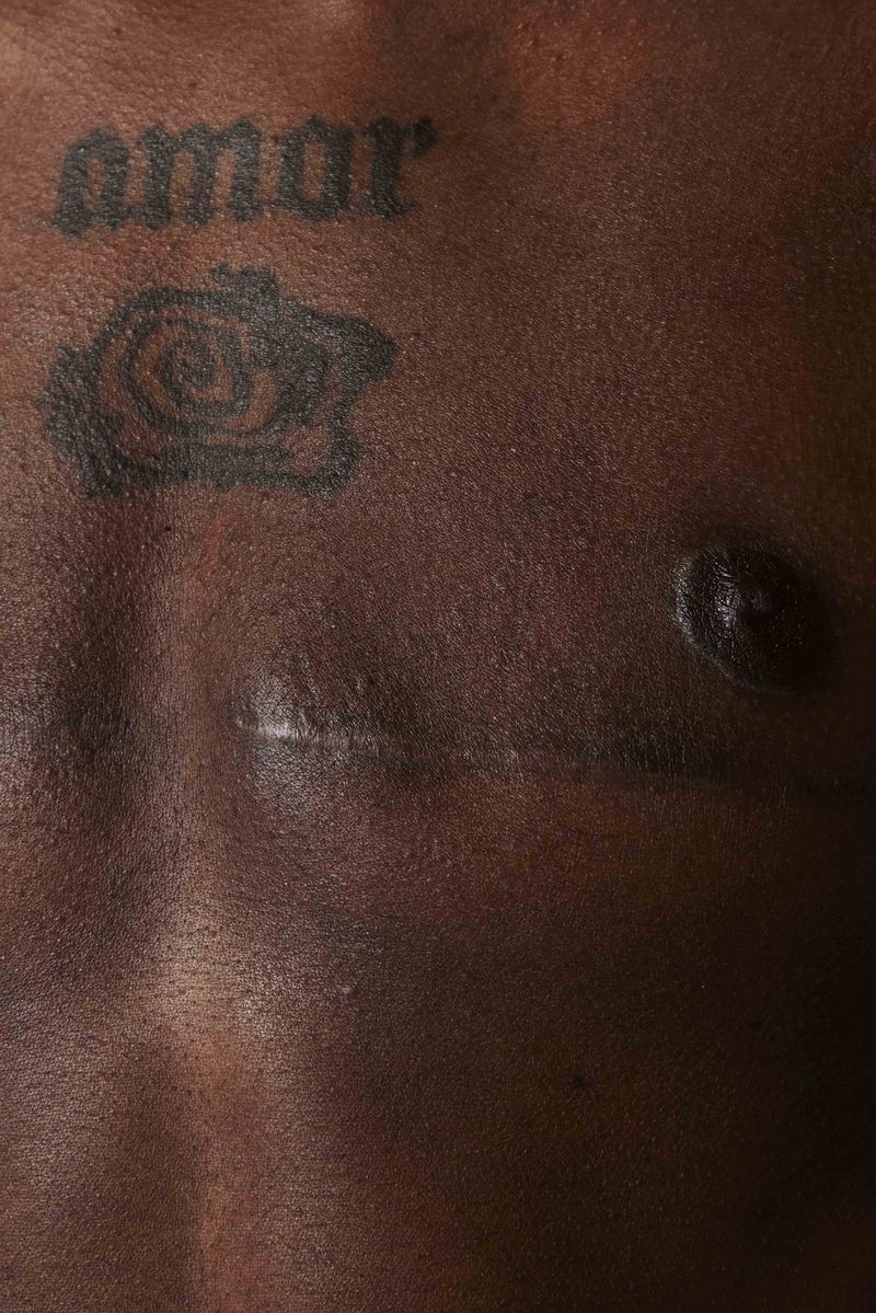 © Prisca Tozzi - Image from the SKIN photography project