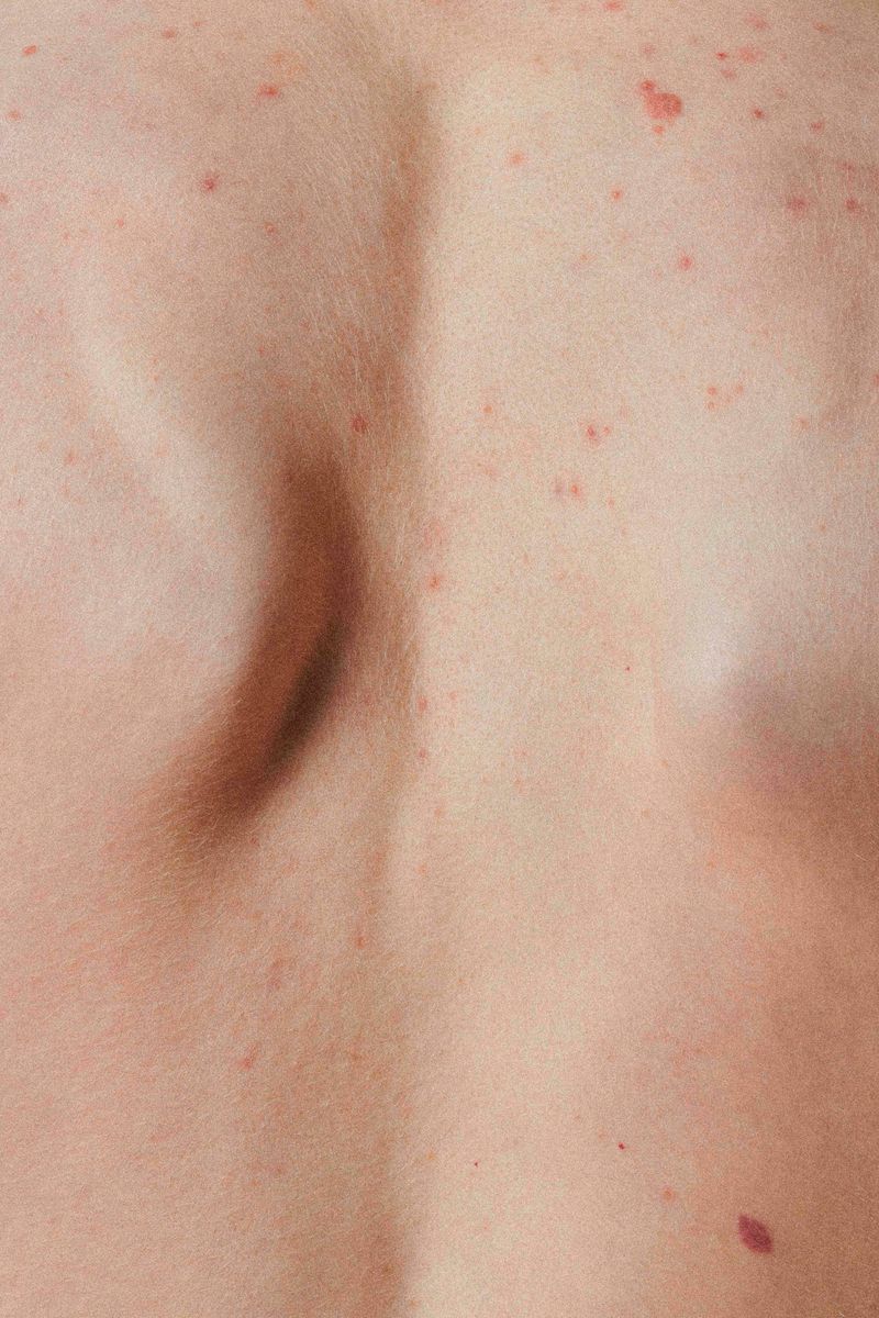 © Prisca Tozzi - Image from the SKIN photography project