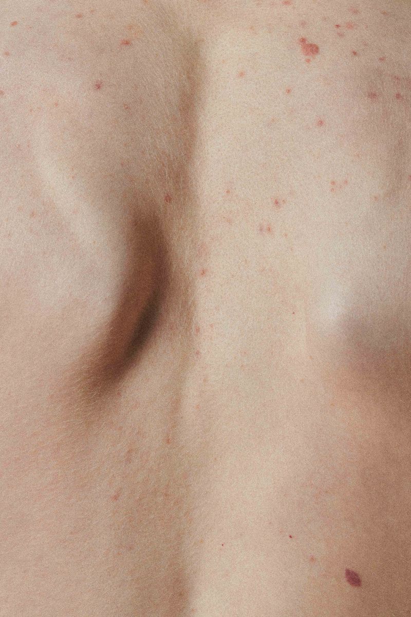 © Prisca Tozzi - Image from the SKIN photography project