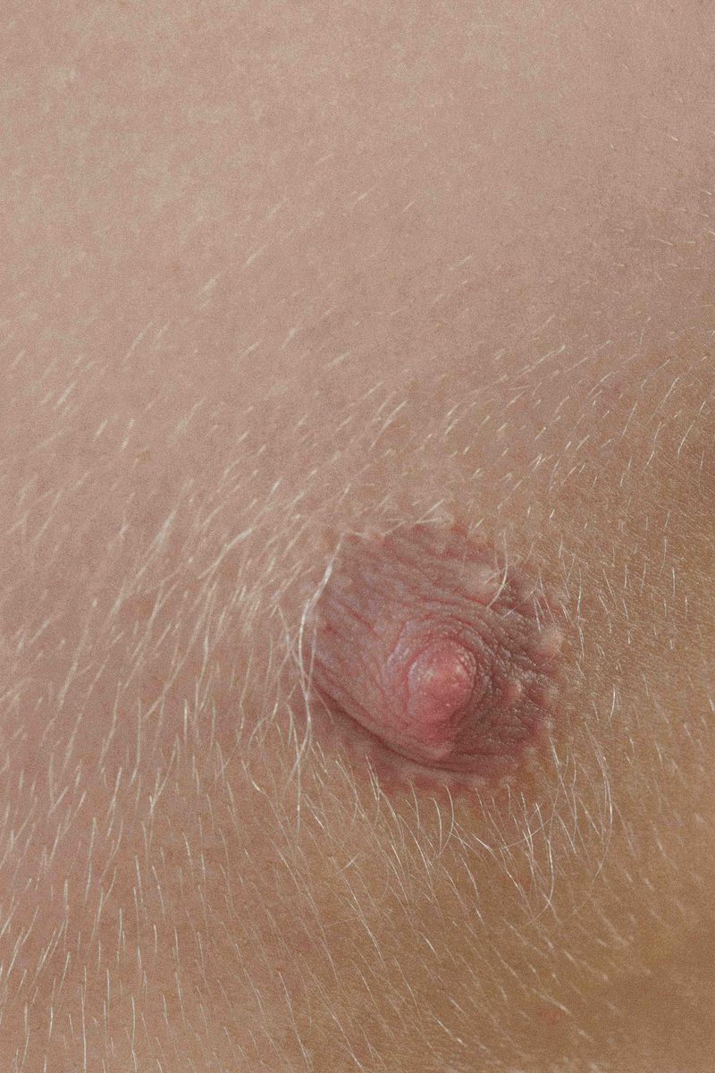 © Prisca Tozzi - Image from the SKIN photography project