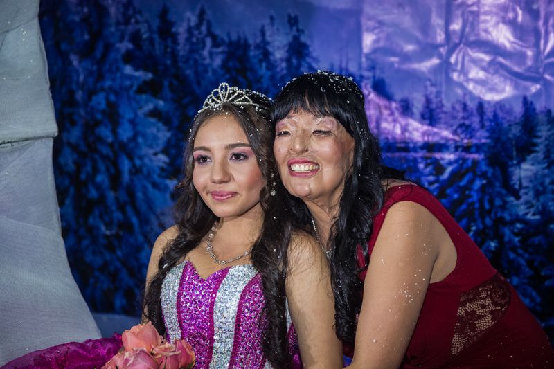 © Betty Laura Zapata - Image from the Facing Up: Acid Attacks in Colombia  photography project