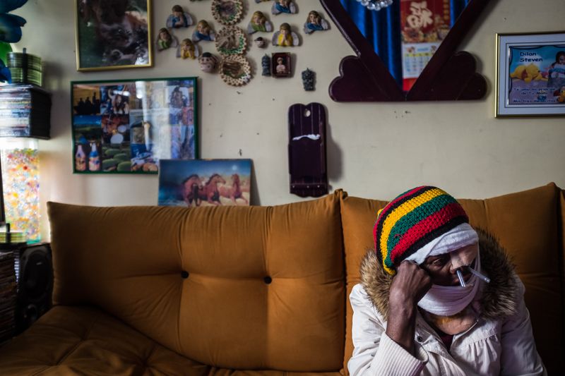 © Betty Laura Zapata - Image from the Facing Up: Acid Attacks in Colombia  photography project