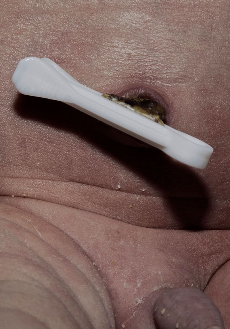 © Marta Szymanowska - Image from the Hydra photography project