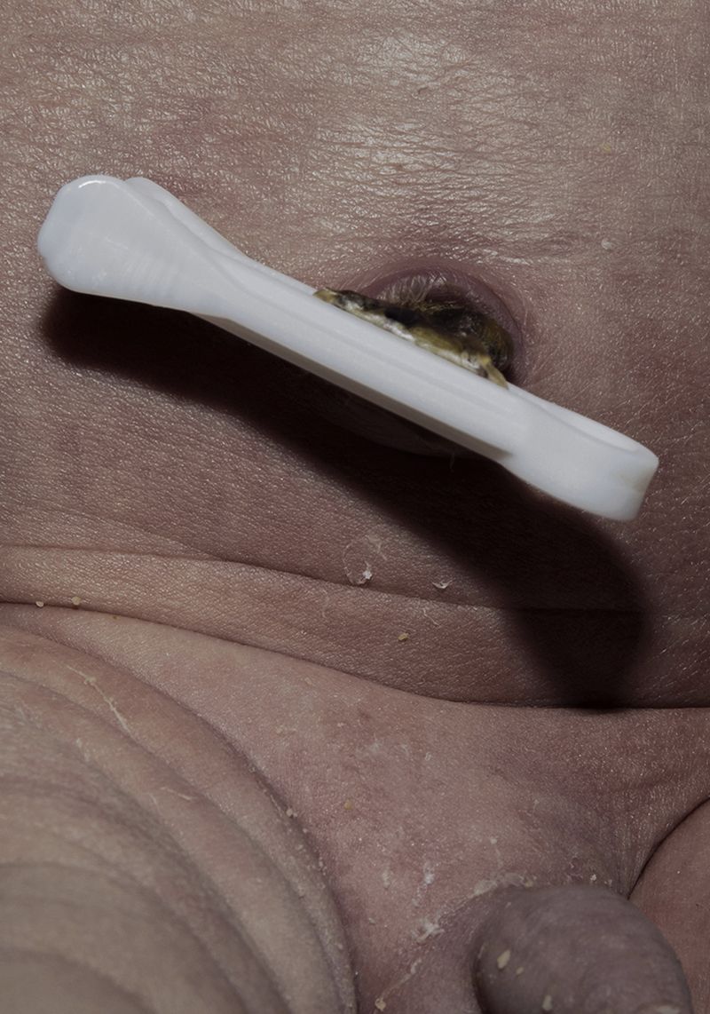© Marta Szymanowska - Image from the Hydra photography project