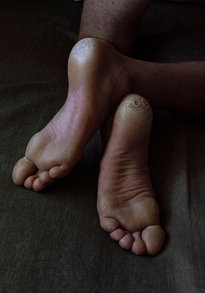 © Marta Szymanowska - Image from the Hydra photography project