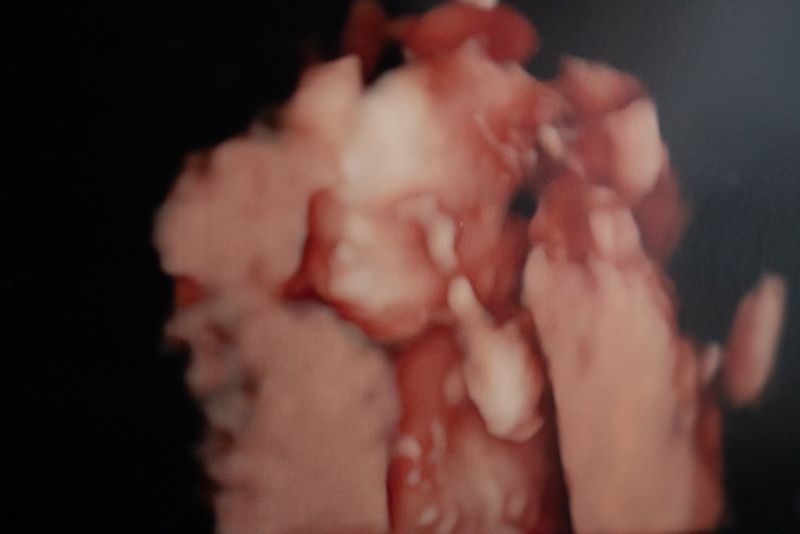 © Ana María Cañas - Image from the Matrescence. Chapter 1: Pregnancy. photography project