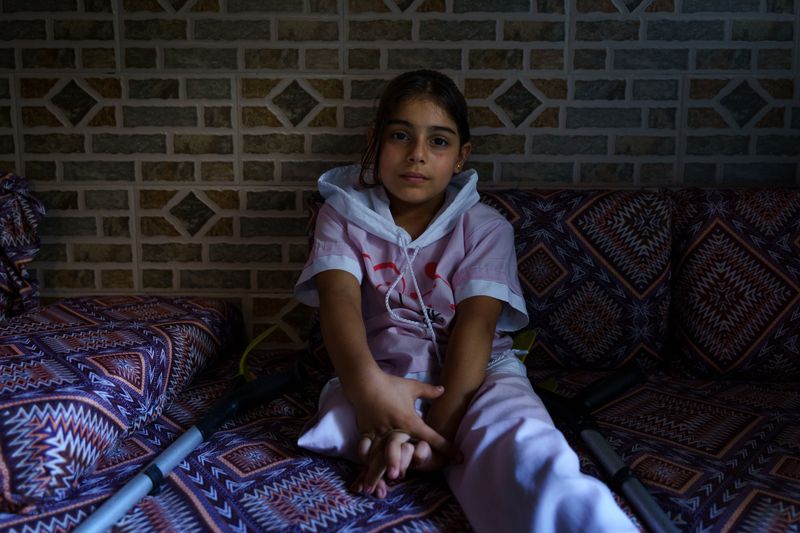 © Maxime Le Lijour - Image from the Gaza's amputees still wait for artificial limbs photography project