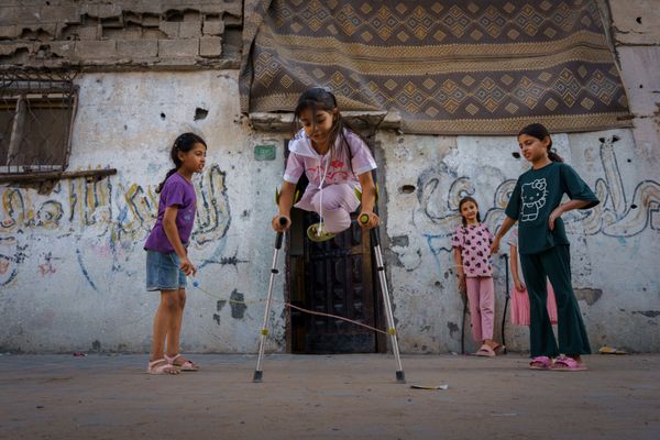© Maxime Le Lijour - Image from the Gaza's amputees still wait for artificial limbs photography project