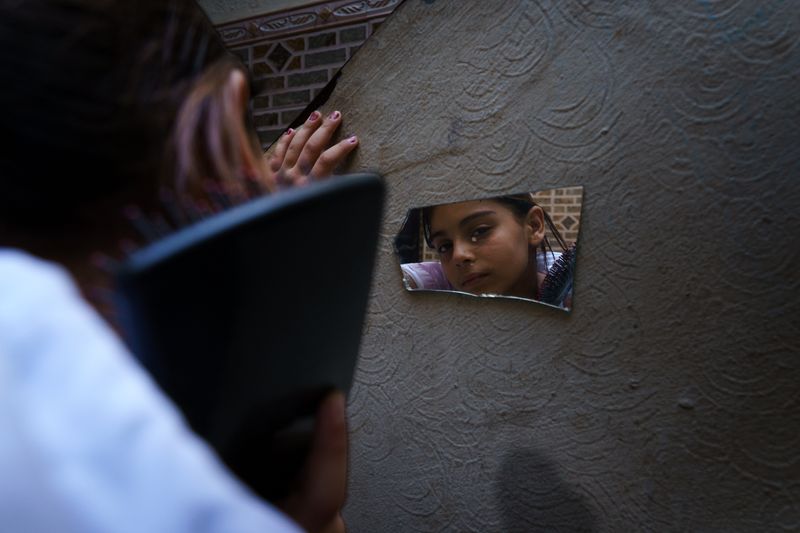 © Maxime Le Lijour - Image from the Gaza's amputees still wait for artificial limbs photography project