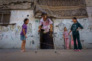 Gaza's amputees still wait for artificial limbs