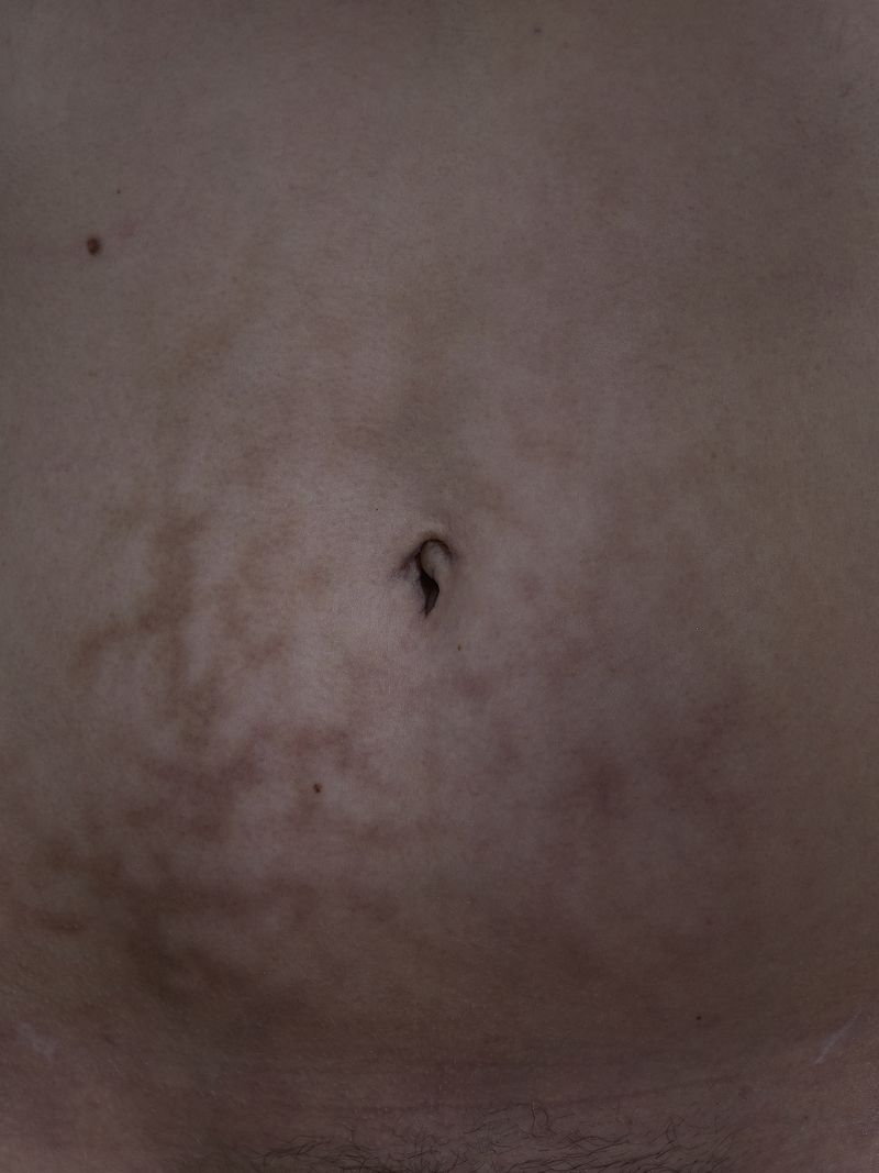 © andrealangphotography - Image from the Endosisters photography project