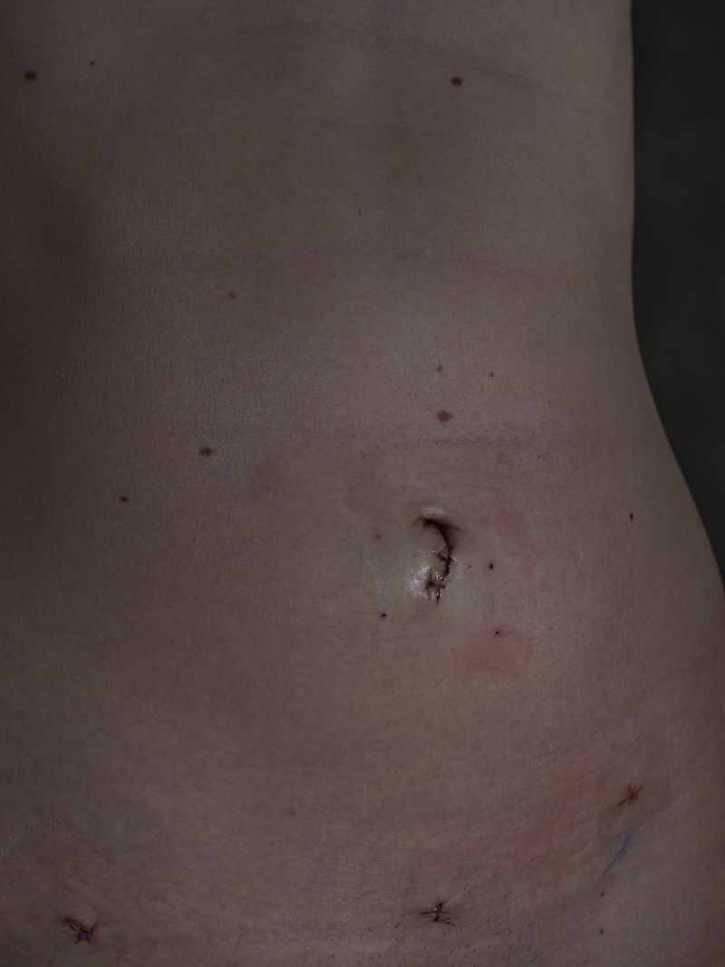 © andrealangphotography - Image from the Endosisters photography project