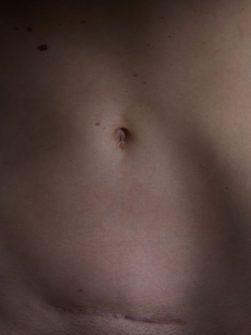 © andrealangphotography - Image from the Endosisters photography project