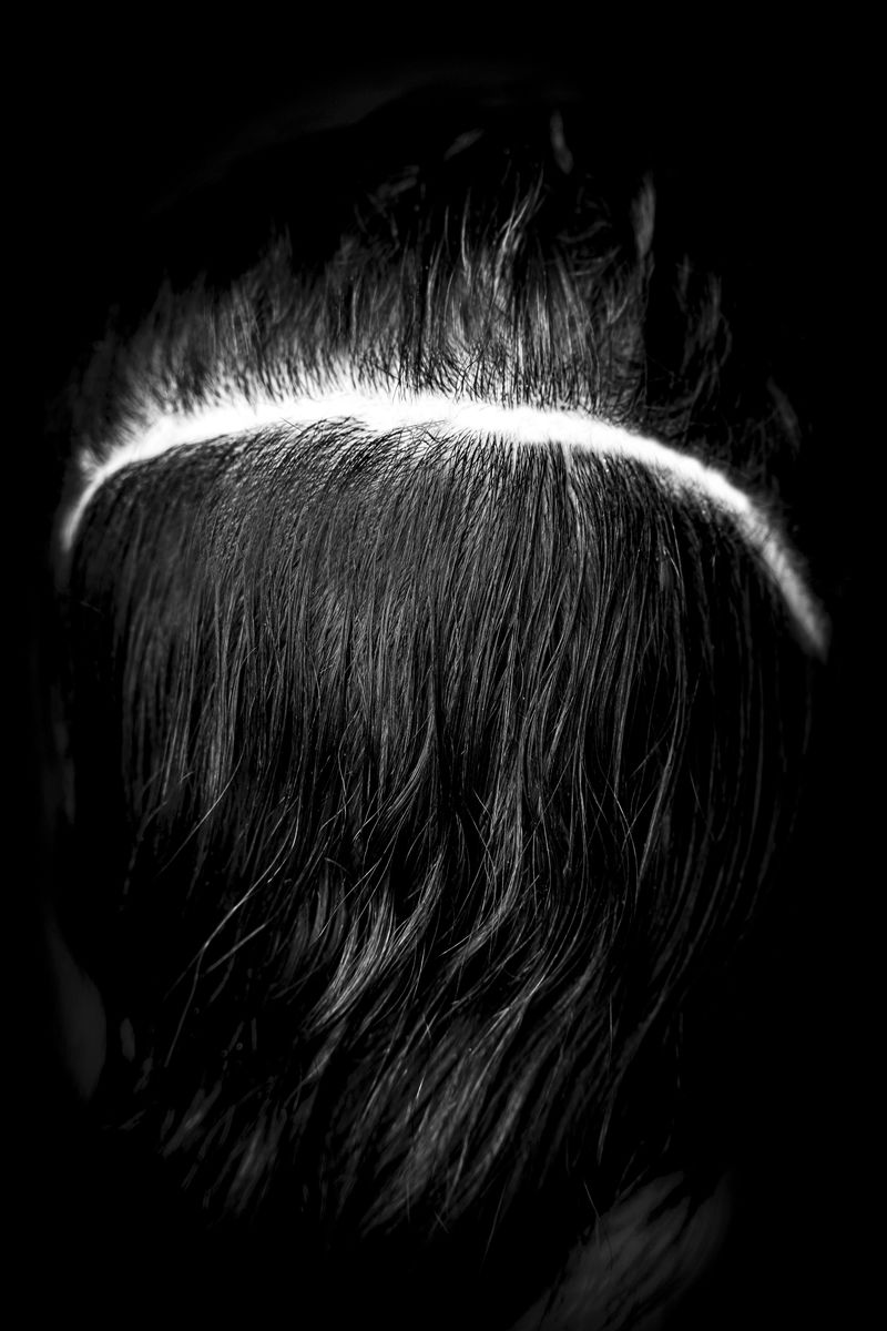 © Niccolò Zorza - Image from the Scars - Behind every scar there is a story photography project