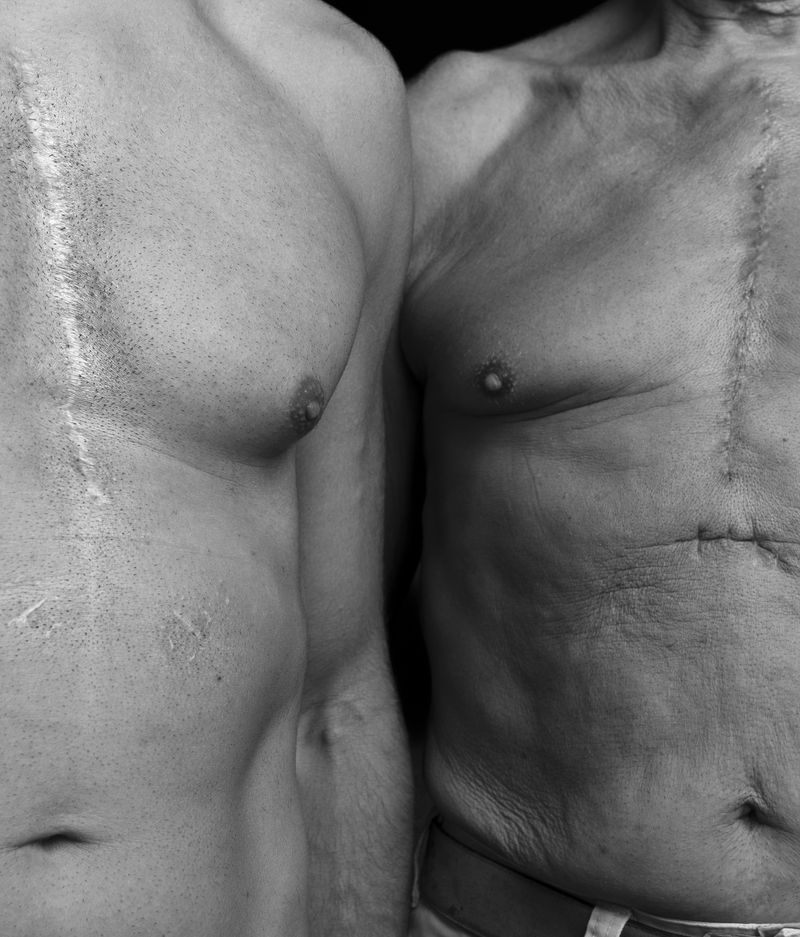 © Niccolò Zorza - Image from the Scars - Behind every scar there is a story photography project