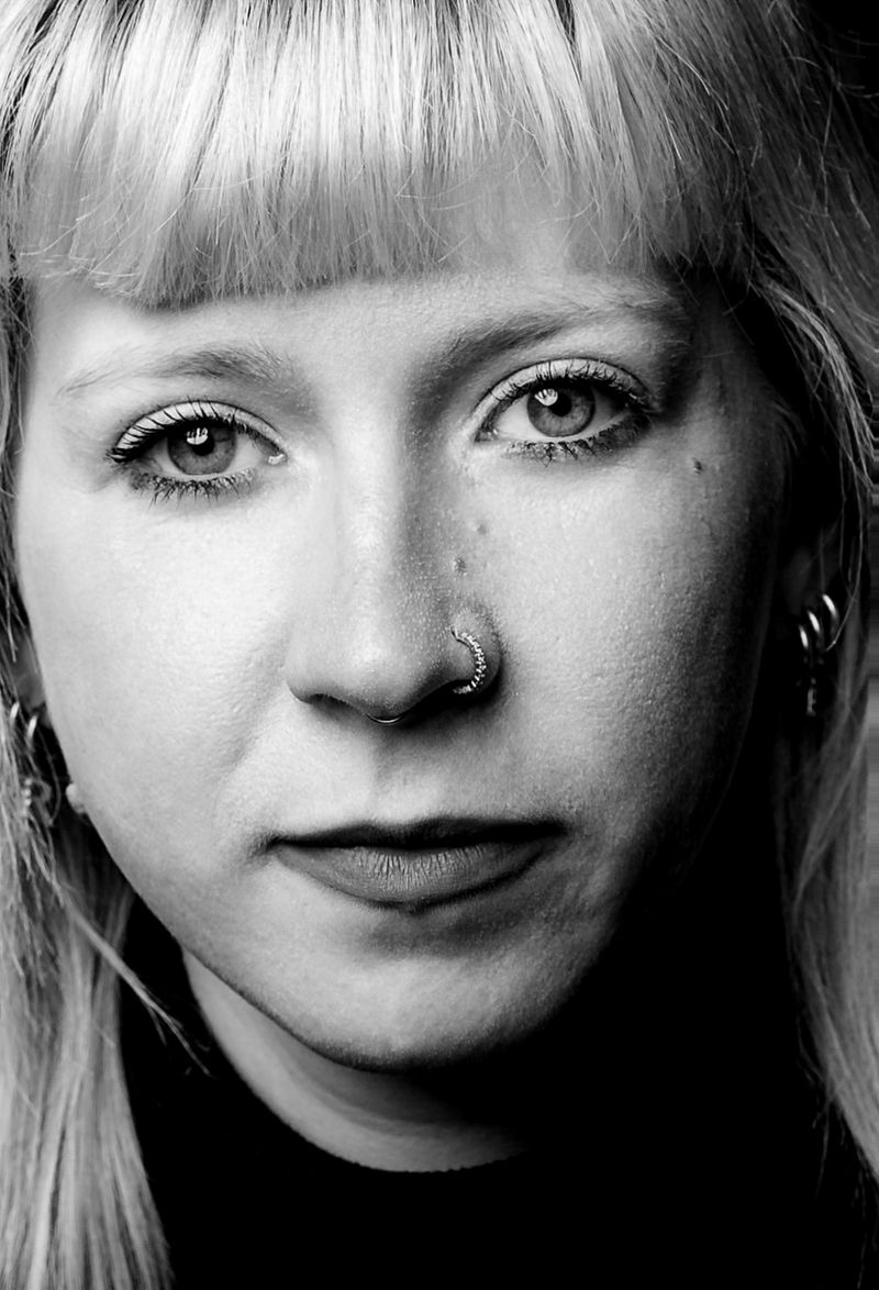 © Niccolò Zorza - Image from the Scars - Behind every scar there is a story photography project